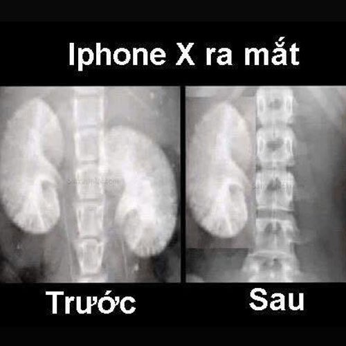 Bộ 3 iPhone X, iPhone 8 và 8 Plus ra mắt, dân tình rủ nhau... bán ...