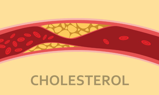 Mật ong Cải thiện cholesterol